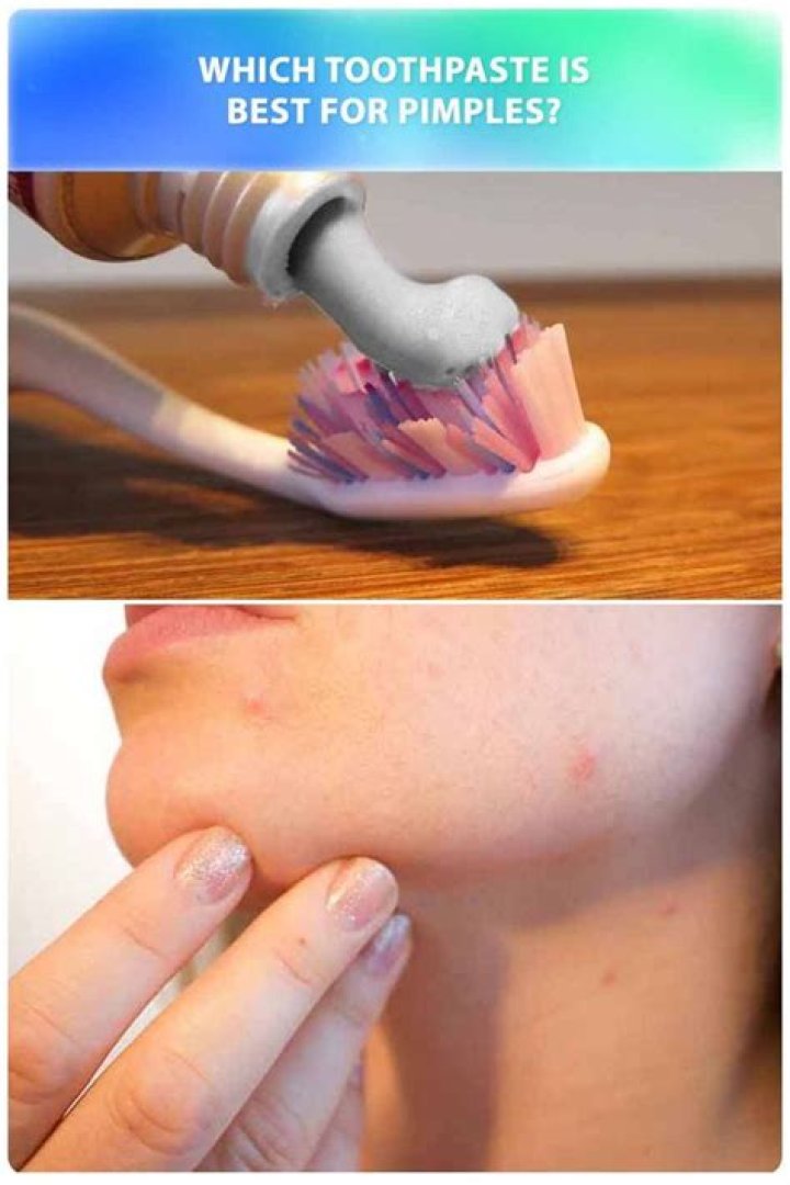 Amanda Seyfried Uses Toothpaste To Get Rid Of Pimples! Does It Work?