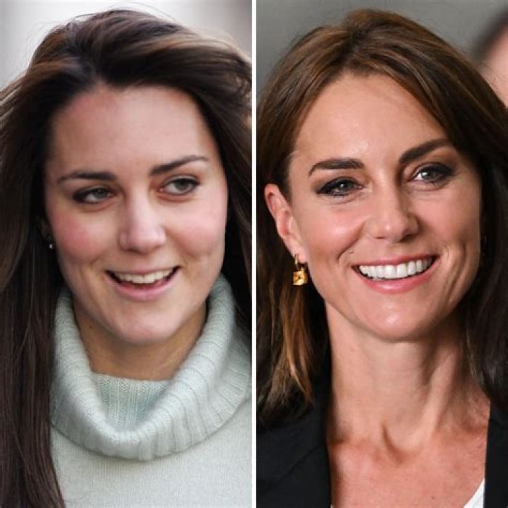 Kate Middleton Plastic Surgery Rumors Shut Down By Kensington Palace – Hollywood Life
